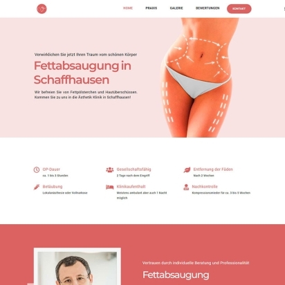 liposuction-schaffhausen.ch